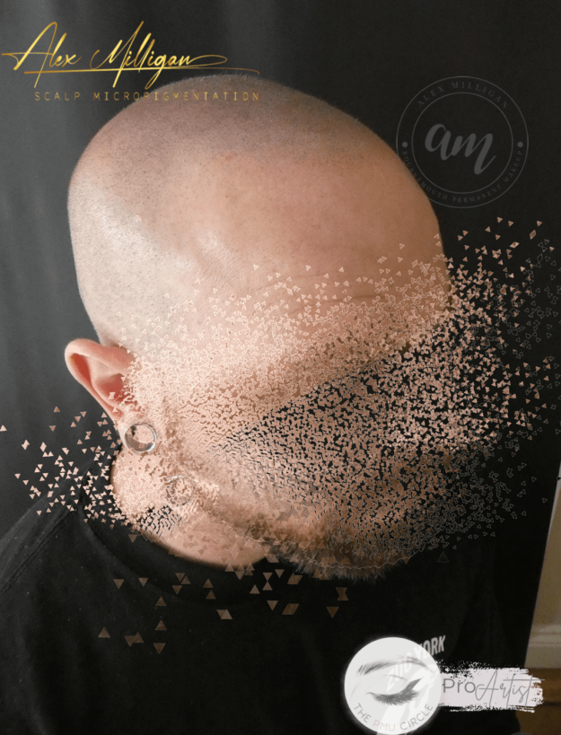 Scalp Tattoo Bournemouth - SCALP TATTOO BY Alex Milligan